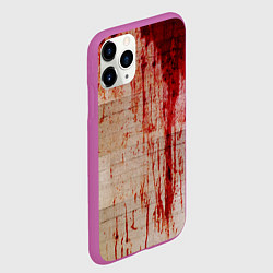 Чехол iPhone 11 Pro матовый Бинты 1, цвет: 3D-фиолетовый — фото 2