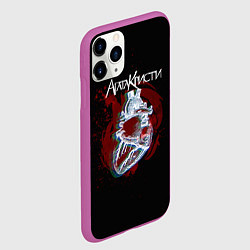 Чехол iPhone 11 Pro матовый Агата Кристи, цвет: 3D-фиолетовый — фото 2