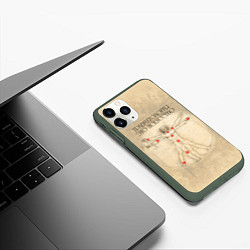 Чехол iPhone 11 Pro матовый Травматология как искусство, цвет: 3D-темно-зеленый — фото 2