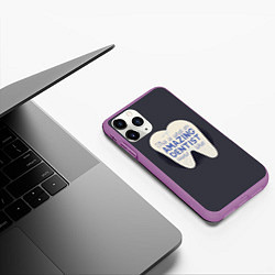 Чехол iPhone 11 Pro матовый Amazing Dentist, цвет: 3D-фиолетовый — фото 2