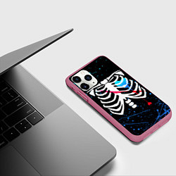 Чехол iPhone 11 Pro матовый UNDERTALE, цвет: 3D-малиновый — фото 2