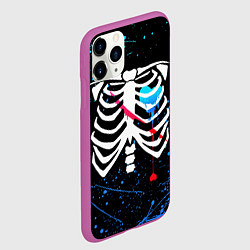 Чехол iPhone 11 Pro матовый UNDERTALE, цвет: 3D-фиолетовый — фото 2