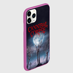 Чехол iPhone 11 Pro матовый Cannibal Corpse Труп Каннибала Z, цвет: 3D-фиолетовый — фото 2