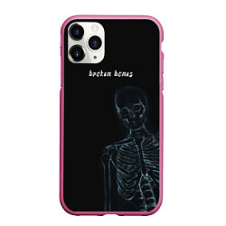 Чехол iPhone 11 Pro матовый Broken bones, цвет: 3D-малиновый