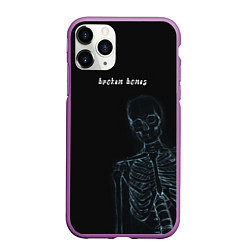 Чехол iPhone 11 Pro матовый Broken bones, цвет: 3D-фиолетовый