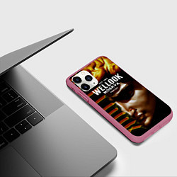 Чехол iPhone 11 Pro матовый Davids Face Look, цвет: 3D-малиновый — фото 2