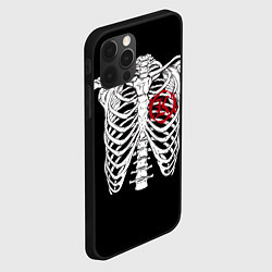 Чехол для iPhone 12 Pro Max Кукрыниксы: Скелет, цвет: 3D-черный — фото 2