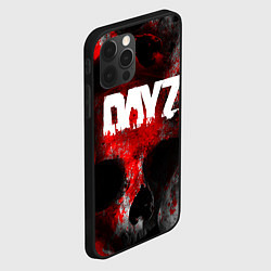 Чехол для iPhone 12 Pro Max DAYZ BLOOD ДЕЙЗИ КРОВЬ Z, цвет: 3D-черный — фото 2