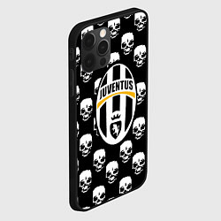 Чехол для iPhone 12 Pro Max Ювентус черепа, цвет: 3D-черный — фото 2