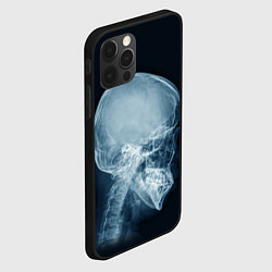 Чехол для iPhone 12 Pro Рентген головы, цвет: 3D-черный — фото 2