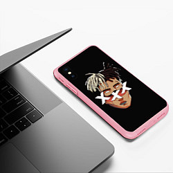 Чехол iPhone XS Max матовый XXXTentacion Head, цвет: 3D-баблгам — фото 2