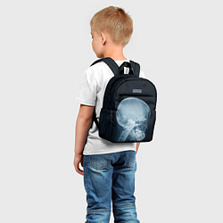 Детский рюкзак Рентген головы, цвет: 3D-принт — фото 2